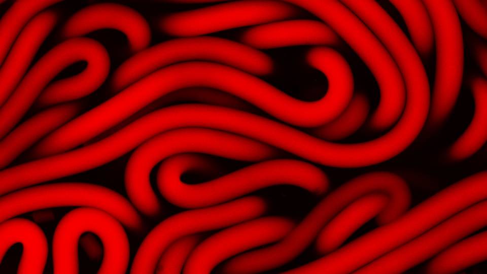 injectable hydrogels