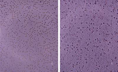 blood cells